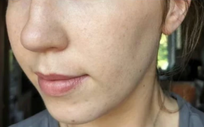 Ellen M. after