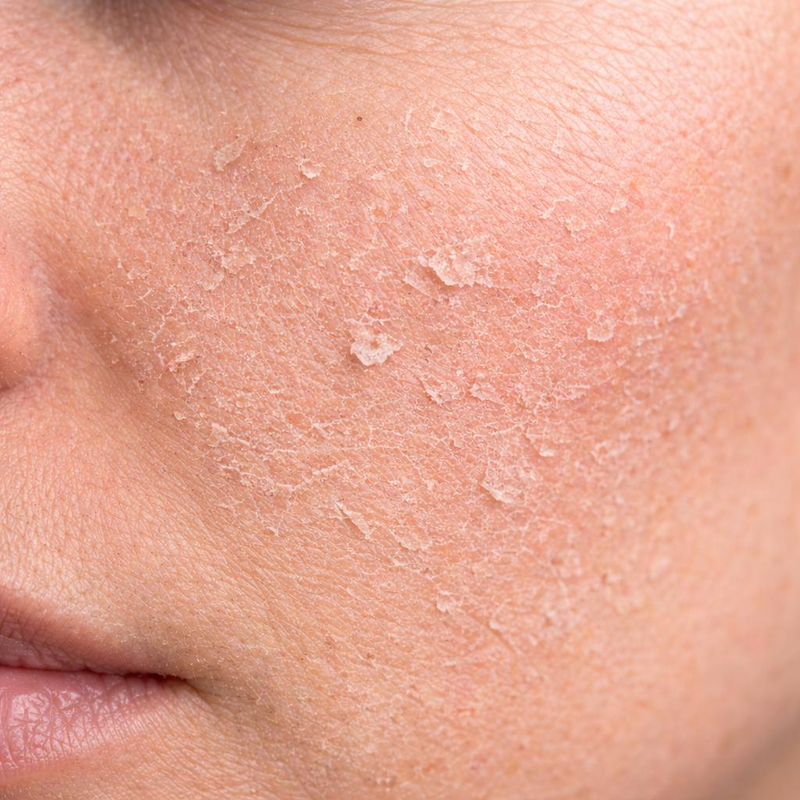 Why more products can leave skin feeling worse